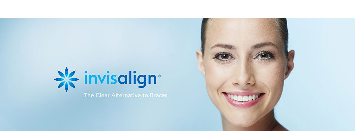 straighten teeth issaquah